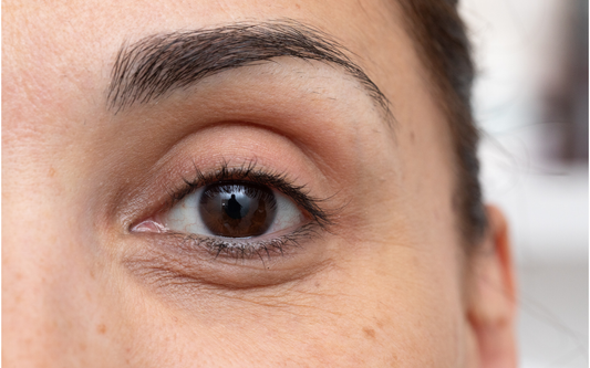 Why Does My Under-Eye Area Look Hollow? How to Care for Them